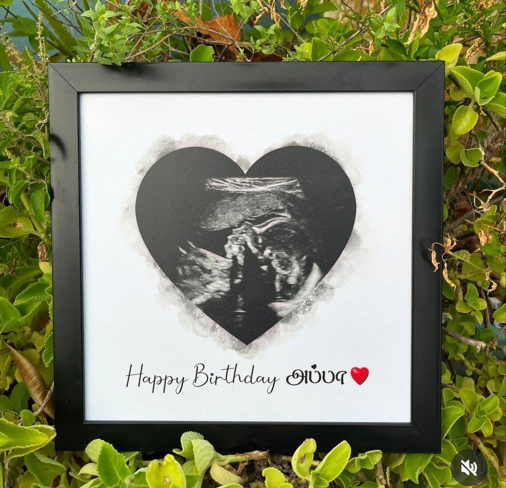 🖼️ Personalized Baby Ultrasound Frame – Custom Pregnancy Announcement Gift