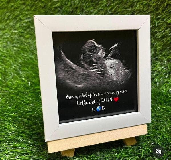 🖼️ Personalized Baby Ultrasound Frame – Custom Pregnancy Announcement Gift